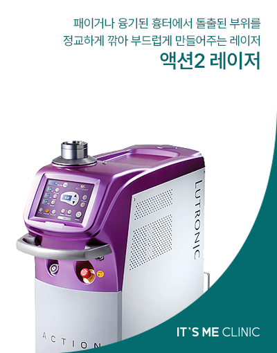 액션2 레이저 썸네일