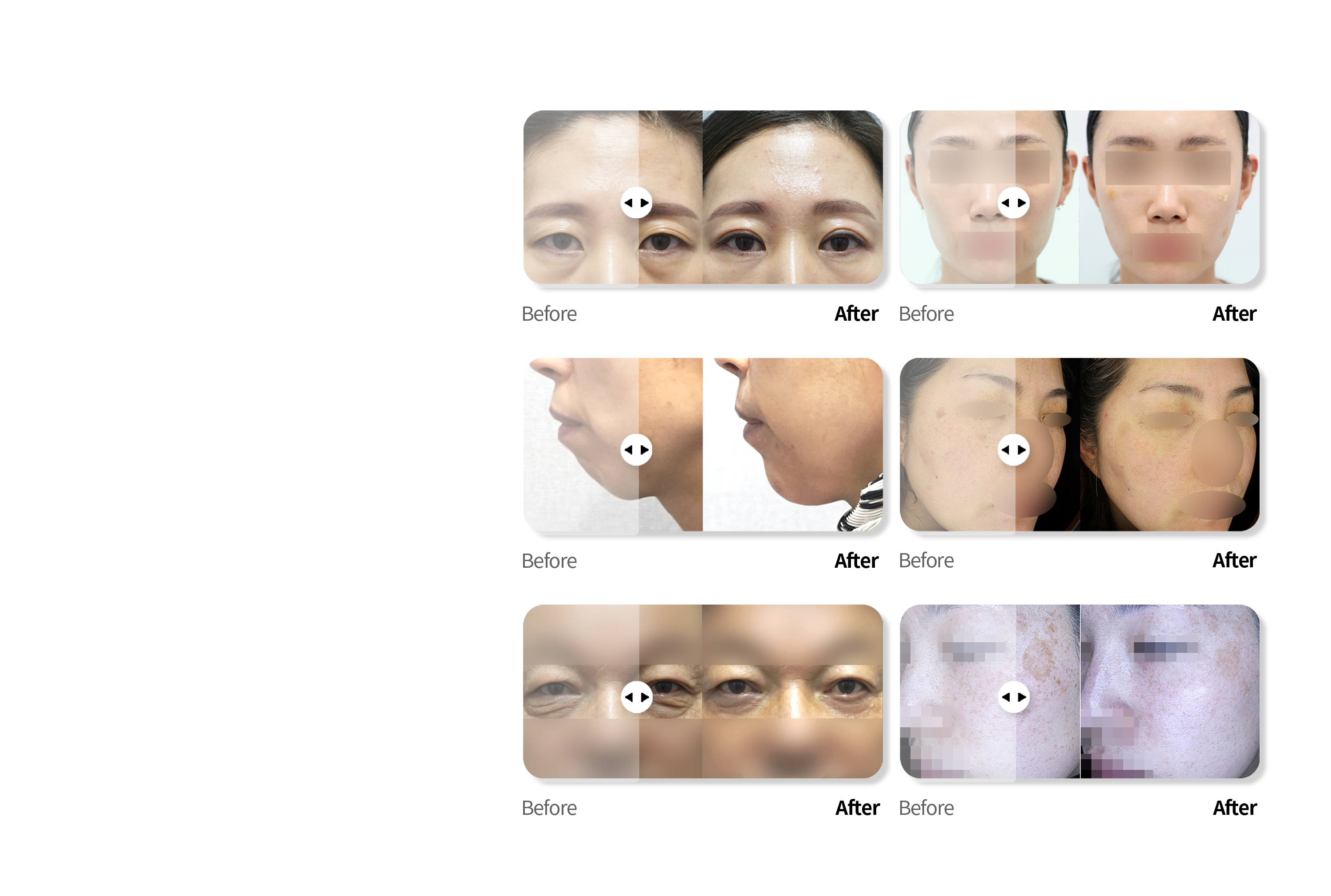 신부점 케이스 전후사진